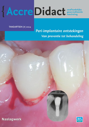 Peri-implantaire ontstekingen - van preventie tot behandeling