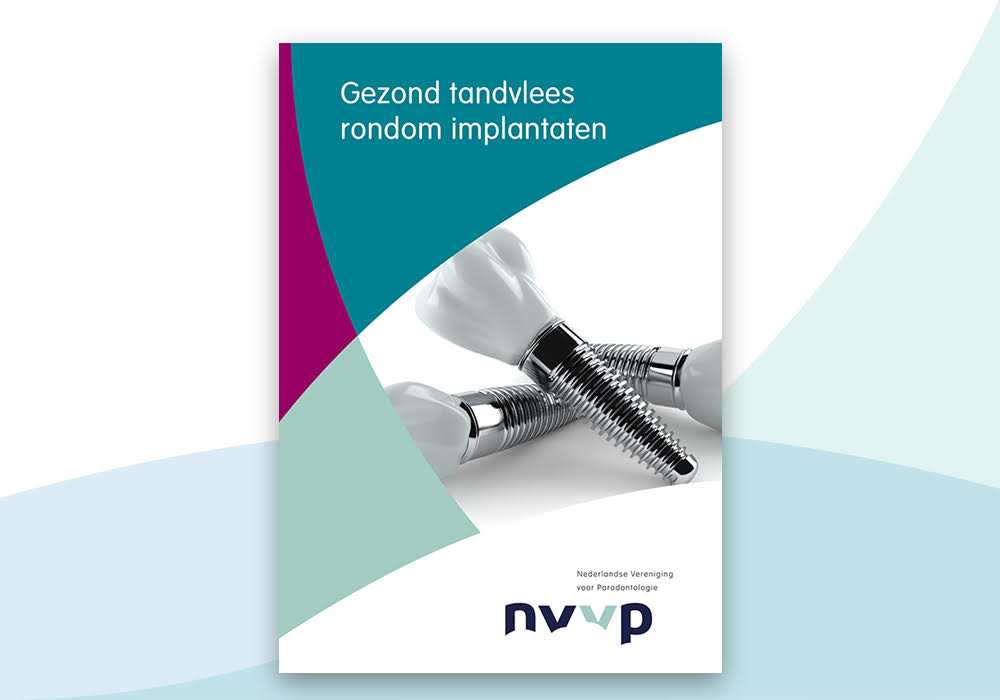 Nieuwe folder: 'Gezond tandvlees rondom implantaten'