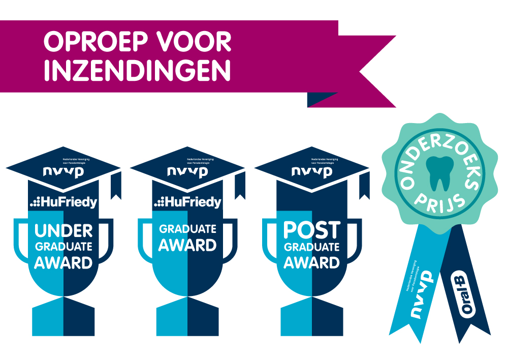 Wint u één van deze vier prijzen?